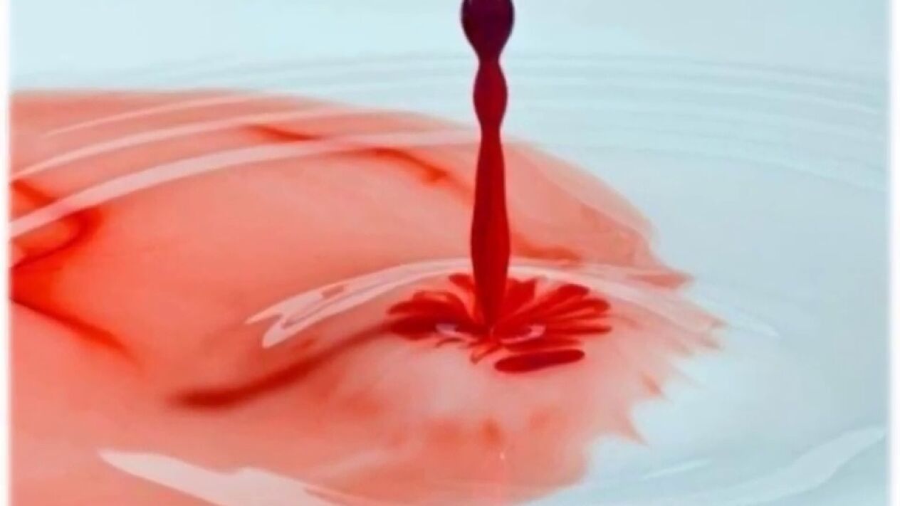 secretion with blood from the penis
